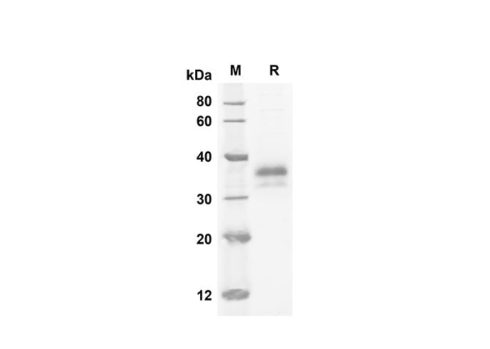 SDS-PAGE analysis of Human IGFBP6 proteins, 2 μg/lane of Recombinant Human IGFBP6 proteins was resolved with SDS-PAGE under reducing conditions, showing bands at 23.3 kDa.