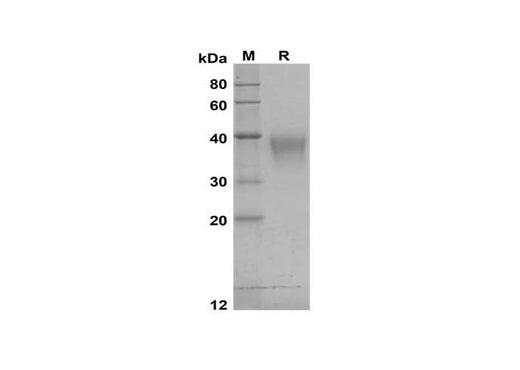 SDS-PAGE analysis of Human TREM-1 proteins, 2 μg/lane of Recombinant Human TREM-1 proteins was resolved with SDS-PAGE under reducing conditions, showing bands at 30-40 kDa.