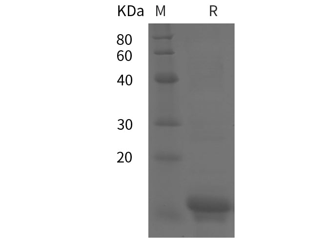 SDS-PAGE analysis of Human IL18 proteins, 2 μg/lane of Recombinant Human IL18 proteins was resolved with SDS-PAGE under reducing conditions, showing bands at 12 kDa.