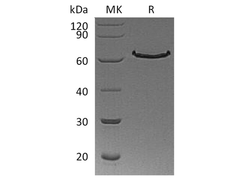 Recombinant Human DLL1/Delta-1 Protein (His Tag) - ABMIUM