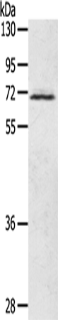 Anti-Human/Mouse/Rat LTA4H Antibody - ABMIUM