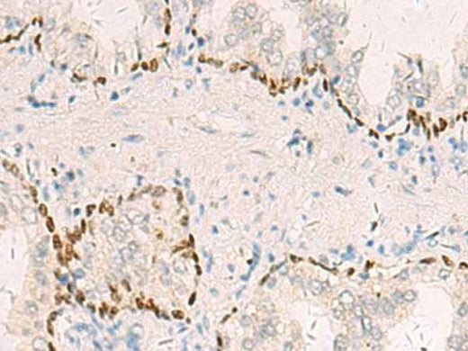 Anti-Human/Mouse/Rat TP63 Antibody