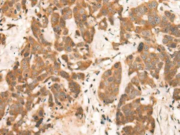 Anti-Human/Mouse/Rat NRG2 Antibody