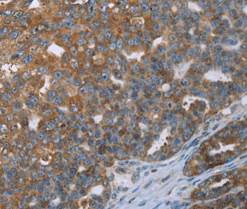 Anti-Human CERS4 Antibody - ABMIUM