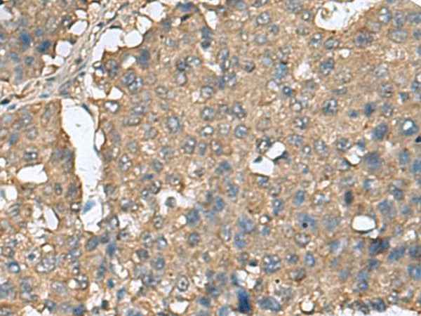 Anti-Human/Mouse/Rat EIF4A2 Antibody
