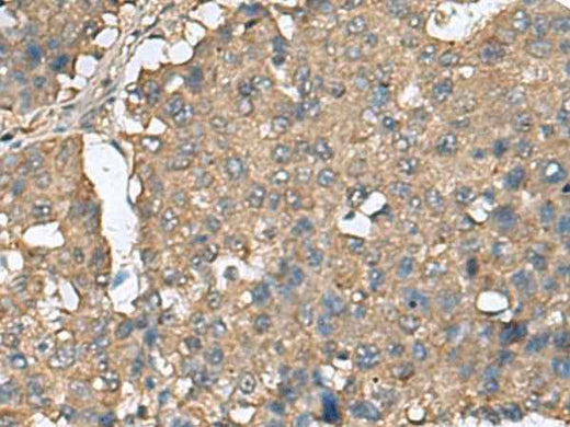 Anti-Human/Mouse/Rat EIF4A2 Antibody