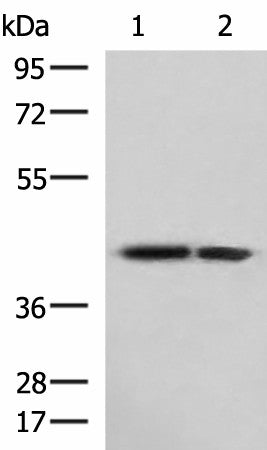 Western blot analysis of Human cerebrum tissue and Human cerebella tissue lysates using ATP6V1C1 Polyclonal Antibody at dilution of 1:800