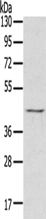 Anti-Human RASSF7 Antibody - ABMIUM
