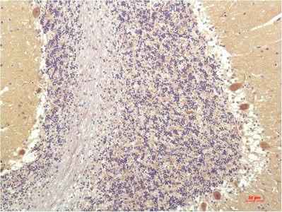 Anti-Human/Mouse/Rat SGK1 Mouse (4D12) Antibody [4D12]