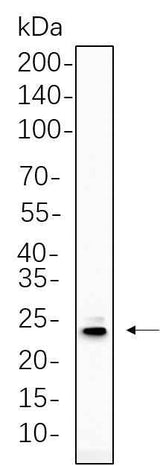Anti-Human/Mouse/Rat PUMA Antibody [B758]