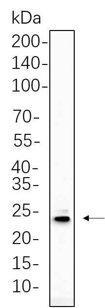 Anti-Human/Mouse/Rat PUMA Antibody [B758]