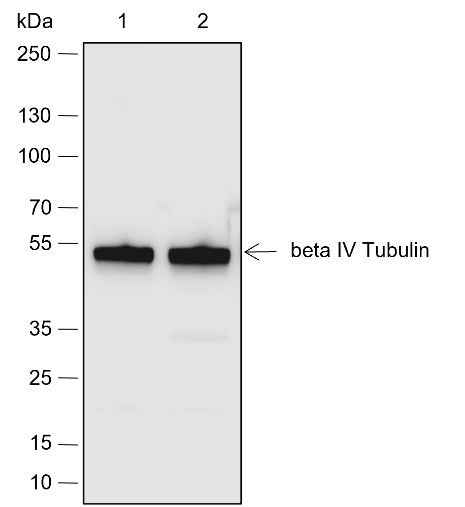 Anti-Human/Rat/Mouse beta IV Tubulin Antibody [A657] - ABMIUM