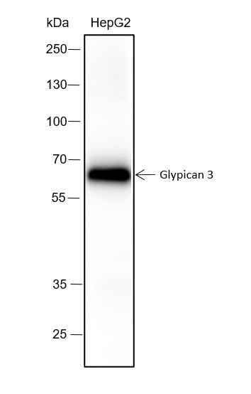 Anti-Human Glypican 3 Antibody [A233] - ABMIUM