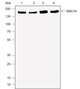 Anti-Human/Mouse SMC1A Antibody [A706] - ABMIUM