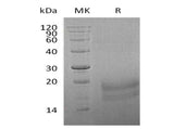 Recombinant Human INSL3 Protein (His Tag) - ABMIUM