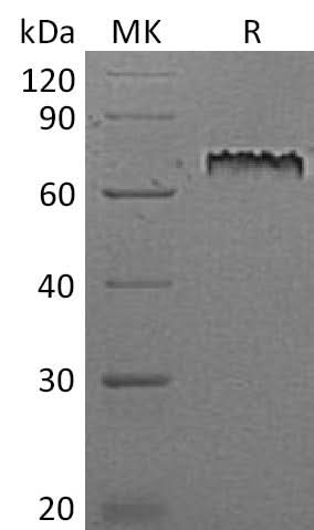 Recombinant Mouse Motch A/NOTCH1 Protein (His Tag) - ABMIUM
