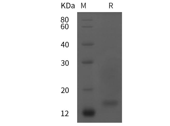 SDS-PAGE analysis of Mouse Transthyretin/Ttr proteins, 2 μg/lane of Recombinant Mouse Transthyretin/Ttr proteins was resolved with SDS-PAGE under reducing conditions, showing bands at 15 kDa.
