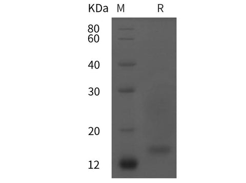 SDS-PAGE analysis of Mouse Transthyretin/Ttr proteins, 2 μg/lane of Recombinant Mouse Transthyretin/Ttr proteins was resolved with SDS-PAGE under reducing conditions, showing bands at 15 kDa.