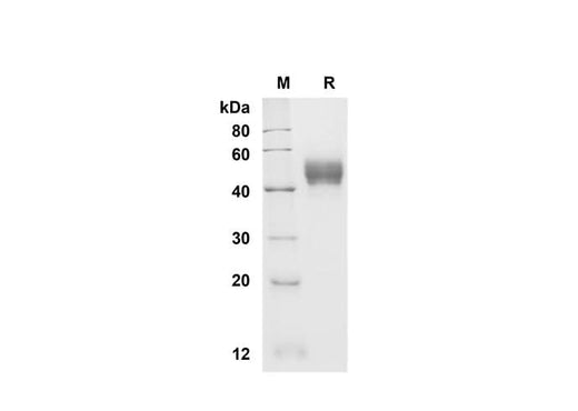 SDS-PAGE analysis of Rat CD14 proteins , 2 μg/lane of Recombinant Rat CD14 proteins was resolved with SDS-PAGE under reducing conditions , showing bands at 45 kDa.