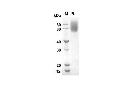 SDS-PAGE analysis of Rat Cd86 proteins, 2 μg/lane of Recombinant Rat Cd86 proteins was resolved with an SDS-PAGE under reducing conditions, showing bands at 49.3 kDa.