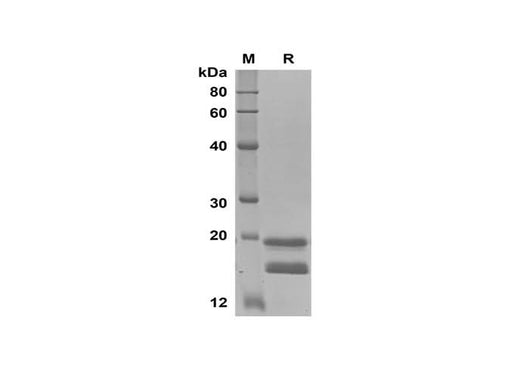 SDS-PAGE analysis of Human IFNα2 proteins, 2 μg/lane of Recombinant Human IFNα2 proteins was resolved with SDS-PAGE under reducing conditions, showing bands at 15-18 kDa.