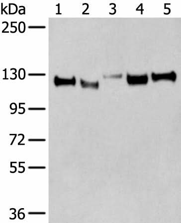 Western blot analysis of Human cerebella tissue Human cerebrum tissue Human fetal brain tissue Mouse brain tissue Rat brain tissue lysates using CNTN1 Polyclonal Antibody at dilution of 1:350