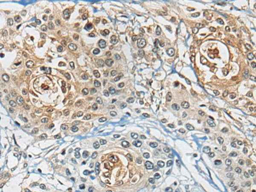 Anti-Human CD8A Antibody