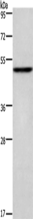 Anti-Human/Mouse/Rat CKMT2 Antibody - ABMIUM
