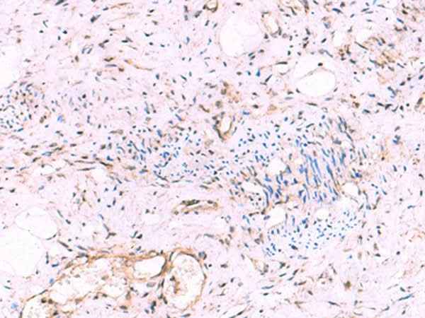 Anti-Human/Mouse/Rat KATNAL1 Antibody