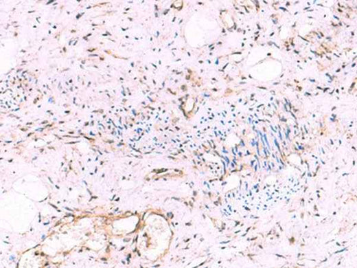 Anti-Human/Mouse/Rat KATNAL1 Antibody
