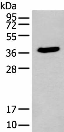 Western blot analysis of HEPG2 cell lysate using ACBD4 Polyclonal Antibody at dilution of 1:400