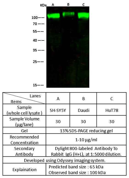 Anti-Rat ALCAM Antibody [B521] - ABMIUM