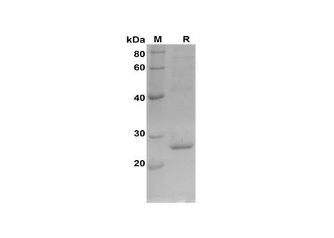 SDS-PAGE analysis of Rat Cyt-C proteins, 2 μg/lane of Recombinant Rat Cyt-C proteins was resolved with SDS-PAGE under reducing conditions, showing bands at 28 kDa.