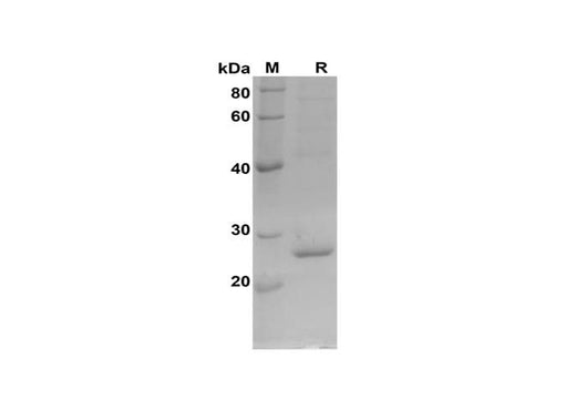 SDS-PAGE analysis of Rat Cyt-C proteins, 2 μg/lane of Recombinant Rat Cyt-C proteins was resolved with SDS-PAGE under reducing conditions, showing bands at 28 kDa.