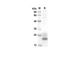 SDS-PAGE analysis of Rat GM-CSF proteins, 2 μg/lane of Recombinant Rat GM-CSF proteins was resolved with an SDS-PAGE under reducing conditions, showing bands at 15.7 kDa.