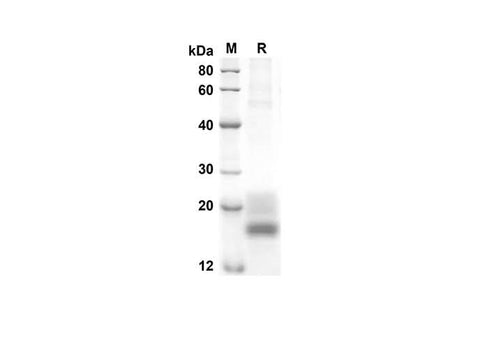 SDS-PAGE analysis of Rat GM-CSF proteins, 2 μg/lane of Recombinant Rat GM-CSF proteins was resolved with an SDS-PAGE under reducing conditions, showing bands at 15.7 kDa.