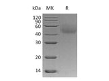Recombinant Human LYVE1/HAR Protein (His Tag) - ABMIUM