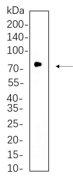 Anti-Human/Mouse/Rat GCLC Antibody [B736] - ABMIUM