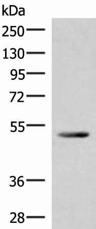 Anti-Human/Mouse IRX4 Antibody