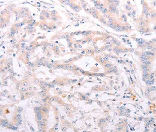 Anti-Human/Mouse ANKRA2 Antibody