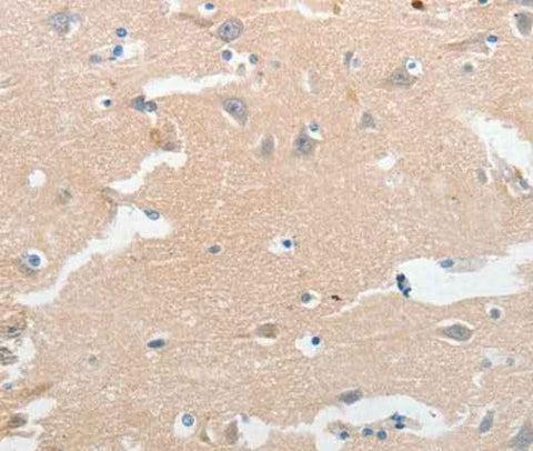 Anti-Human LCN2 Antibody