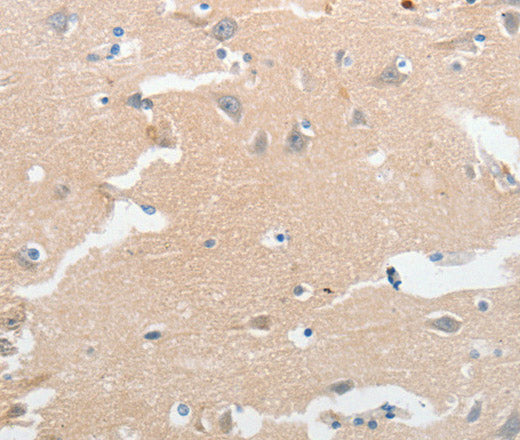 Anti-Human LCN2 Antibody - ABMIUM