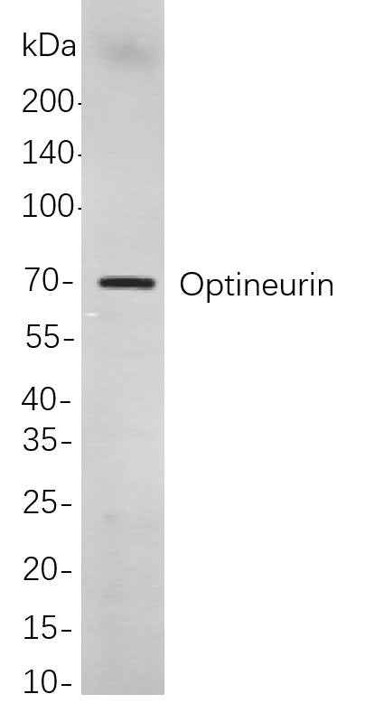 Anti-Human/Mouse/Rat Optineurin Antibody [B828] - ABMIUM