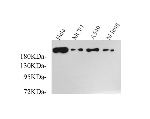 Western Blot analysis of various samples using SMARCA4 Polyclonal Antibody at dilution of 1:750.