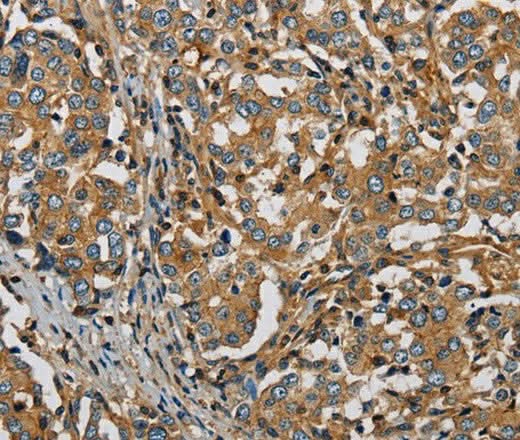 Anti-Human PLIN3 Antibody - ABMIUM