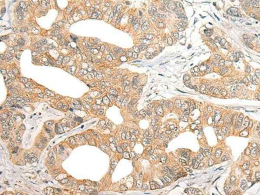 Anti-Human/Mouse SNX6 Antibody