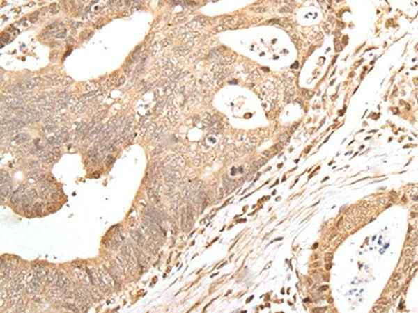 Anti-Human/Mouse GRAP Antibody