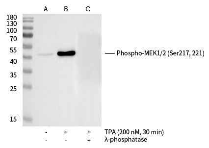 Anti-Human MAP2K1 Antibody [B288] - ABMIUM