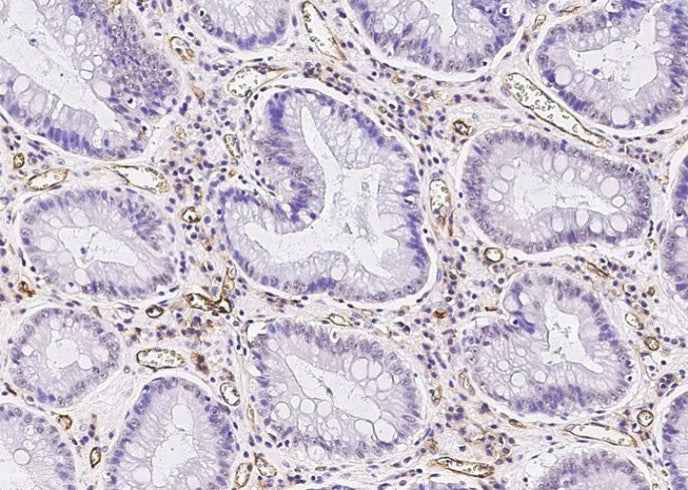 Anti-Human ICAM1 Antibody [A848] - ABMIUM