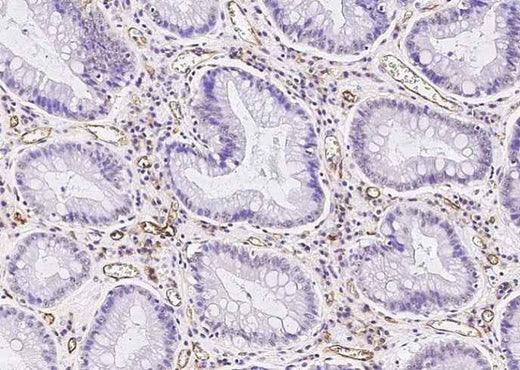 Anti-Human ICAM1 Antibody [A848] - ABMIUM